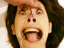 顔面崩壊動画 開口器で歯茎を剥き出し鼻フックで豚鼻を晒す女子