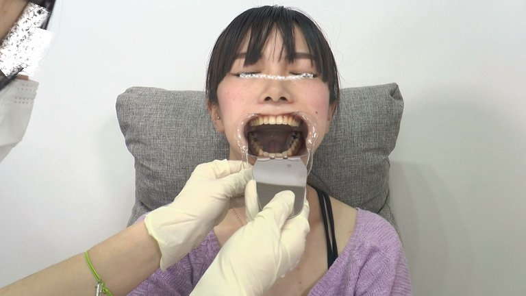女の子の口内と歯5